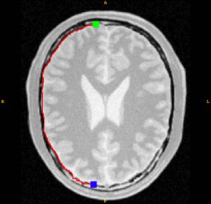 Live-Wire-ing the Insight Toolkit with Intelligent Scissors