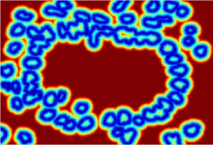 Microscopy Image Analysis: Blob Segmentation using Geodesic Active Contours
