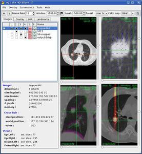 VV: a viewer for the evaluation of 4D image registration