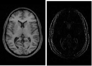 Combinatorial Ricci Curvature for Image Processing