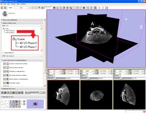 An open-source real-time ultrasound reconstruction system for four-dimensional imaging of moving organs