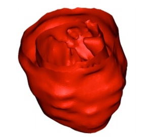 4D Morphological segmentation and the MICCAI LV-segmentation grand challenge