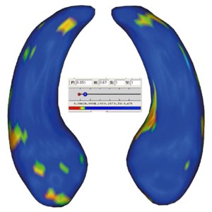Local Shape Analysis using MANCOVA