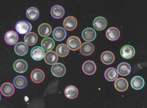 An Optimized N-Dimensional Hough Filter for Detecting Spherical Image Objects