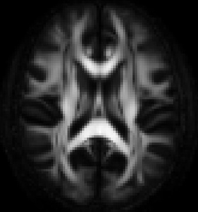 Simulated Diffusion-Weighted Imaging for the ITK Masses